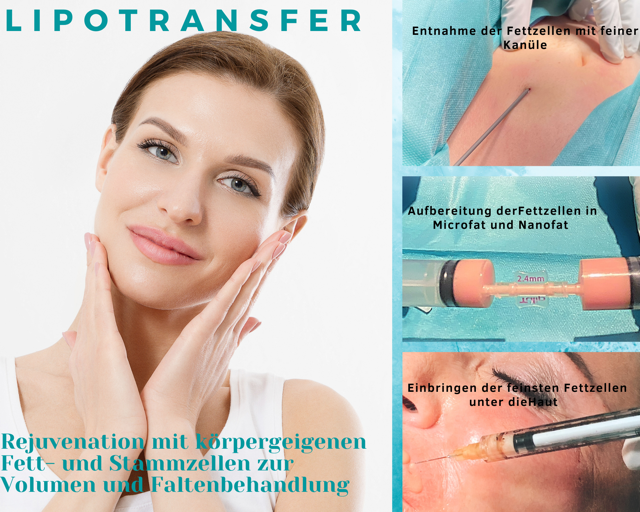 Eigenfettbehandlung Faceclinic in Zürich faceclinic de